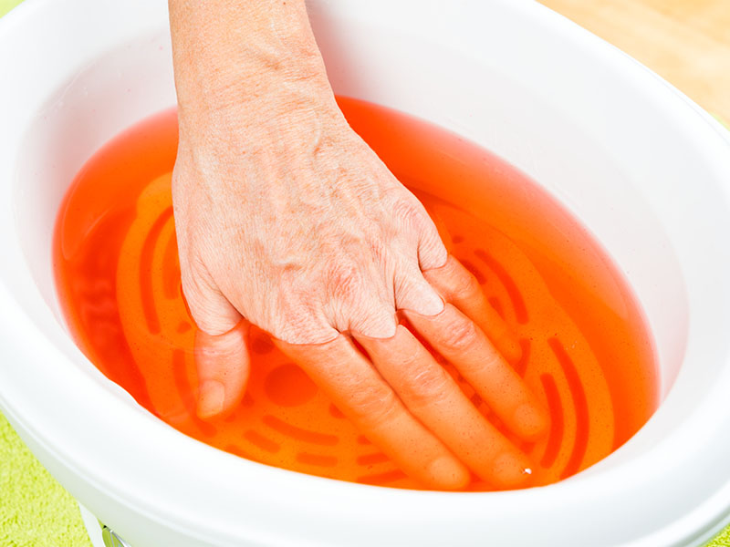 Behandlung einer Hand in einem Paraffinbad als Unterstützung bei der Handtherapie in Lüdenscheid