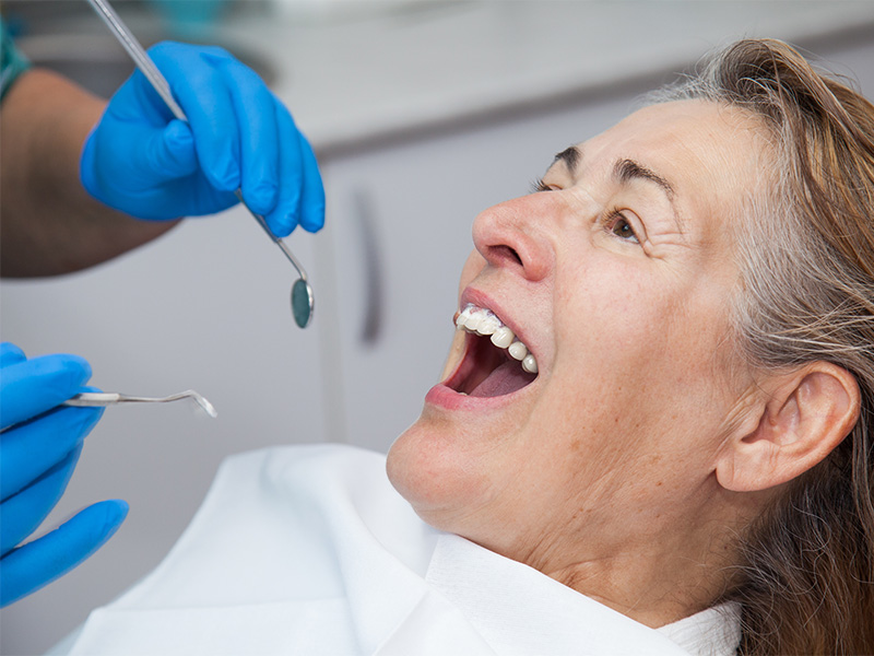 Zahnärztin behandelt entzündetes Zahnfleisch eines Patienten zur Entfernung von Plaque und Gingivitis im Behandlungsstuhl beim Zahnarzt in Lüdenscheid.
