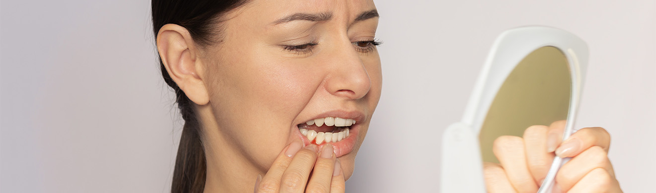 Frau betrachtet gerötetes Zahnfleisch im Spiegel und erkennt Entzündung, wichtiges Motiv zur Parodontose Prophylaxe in Lüdenscheid